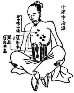 糸練功