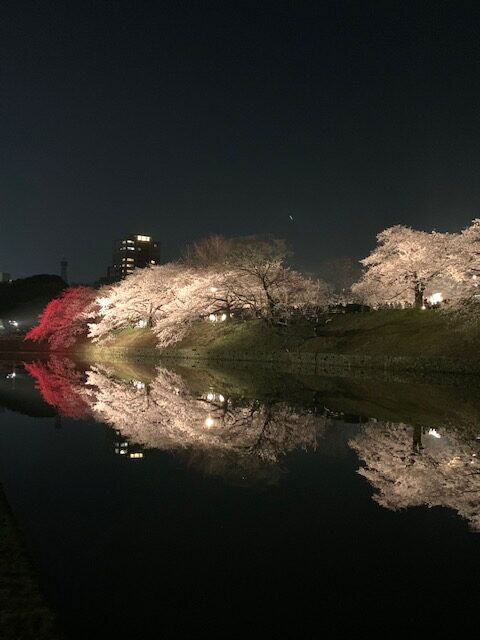 肝硬変と黄疸